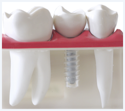 �C���v�����g